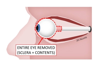 Slide6