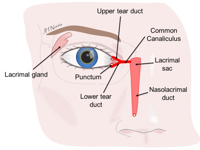 DCR (watery eye) surgery Jonathan Norris